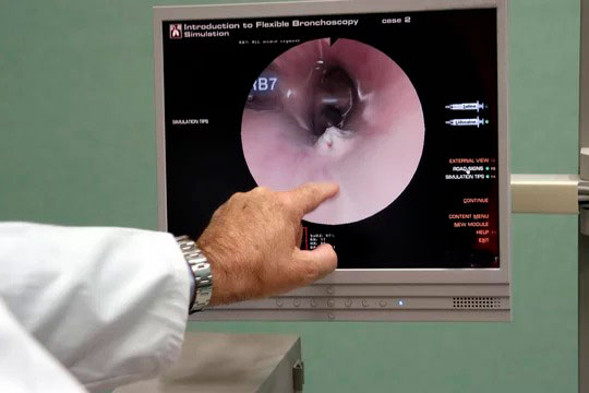 endoscopia laríngea